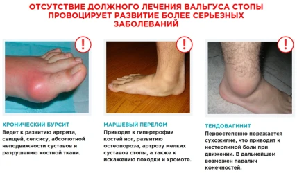 Вальгомед — Возможные побочные эффекты