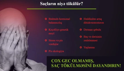 Vihair — Vihair haradan almaq, apteklərdə mövcudluğu və qiymətləri