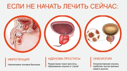 Урофарм — Противопоказания