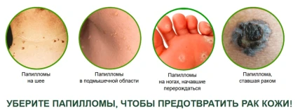 Черный Лекарь — Состав