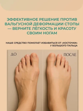 Вальгомед — Где купить Вальгомед, наличие и цены в аптеках