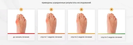 Вальгомед — Состав