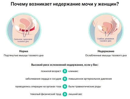 Стопинор — Где купить Стопинор, наличие и цены в аптеках