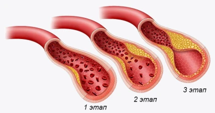 Артери Гель — Где купить Артери Гель, наличие и цены в аптеках