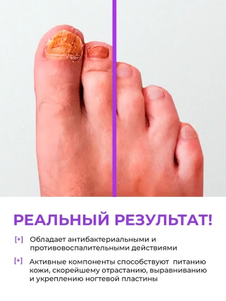 ФунгиСтоп — Показания к применению