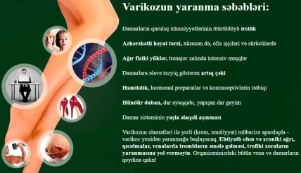 Varix — Varix haradan almaq, apteklərdə mövcudluğu və qiymətləri