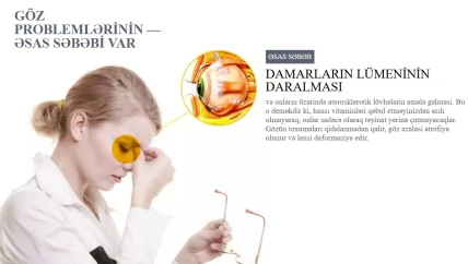 Ocuvist — Farmakodinamika və farmakokinetika