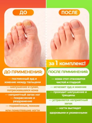 Живоуст — Противопоказания