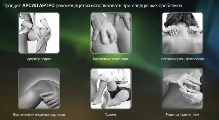 Арсил Артро — Фармакологическая группа