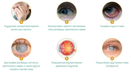 BiOculist — «BiOculist»ni sotib olish, dorixonalarda mavjudligi va narxlari