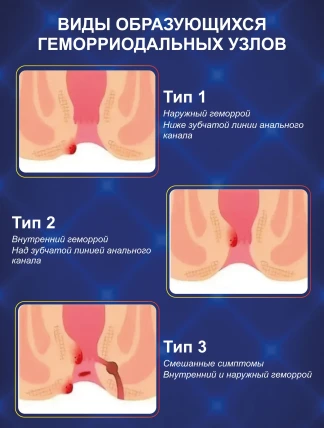 Hemora — Возможные побочные эффекты