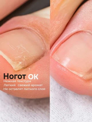 НоготОК — Инструкция по применению